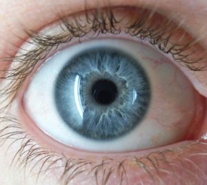 Blue eye color