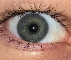 Blue-gray eye color