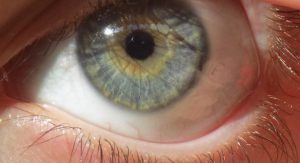 Blue eye color