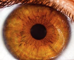 9: Amber Iris