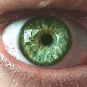 7: Green Iris