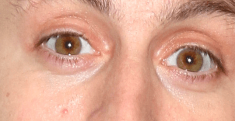 Kieran Culkin eyes up close photos