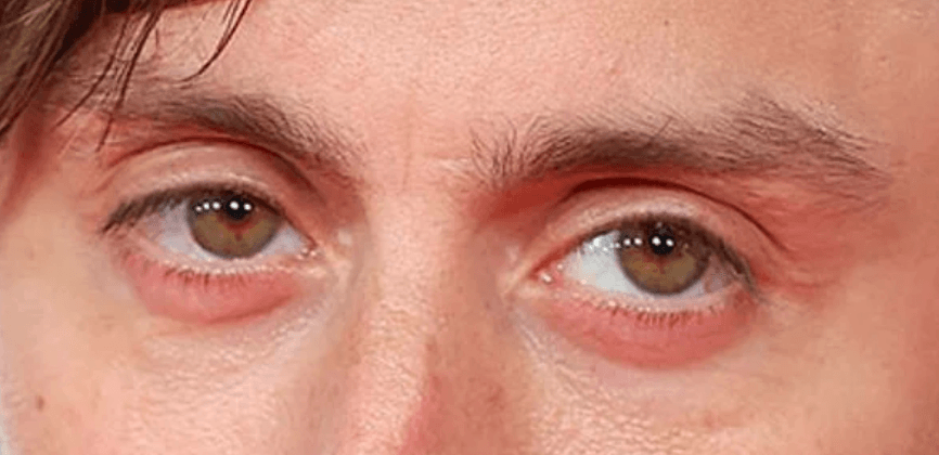 Kieran Culkin eyes up close photos