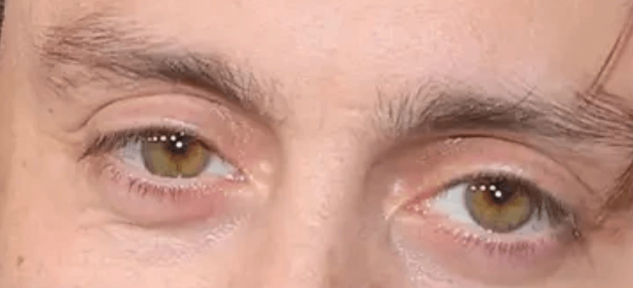 Kieran Culkin eyes up close photos