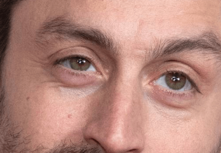 Kieran Culkin eyes up close photos