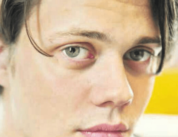 Bill Skarsgård eyes up close photos